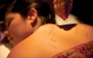 Experience deep relaxation, stress reduction and general positive health effect with Acupuncture.