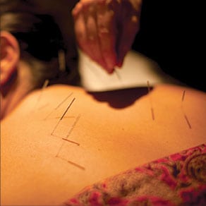 Experience deep relaxation, stress reduction and general positive health effect with Acupuncture.